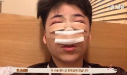 整形爆料视频大全,热门爆料视频大盘点